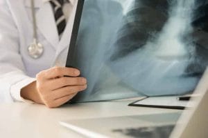 Decisão judicial garante pagamento retroativo de adicional de férias a profissional de radiologia 1 | Juristas Exame de Raio X
