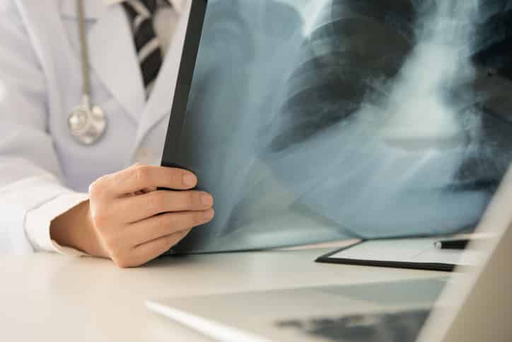 Médica que deu alta prematura a paciente com lesão na coluna terá de indenizá-lo 1 | Juristas Exame de Raio X